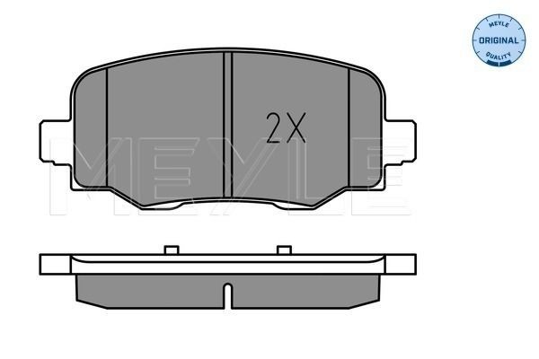 MEYLE Gasket Set, planetary gearbox Article number: 034 035 0034 cheaply